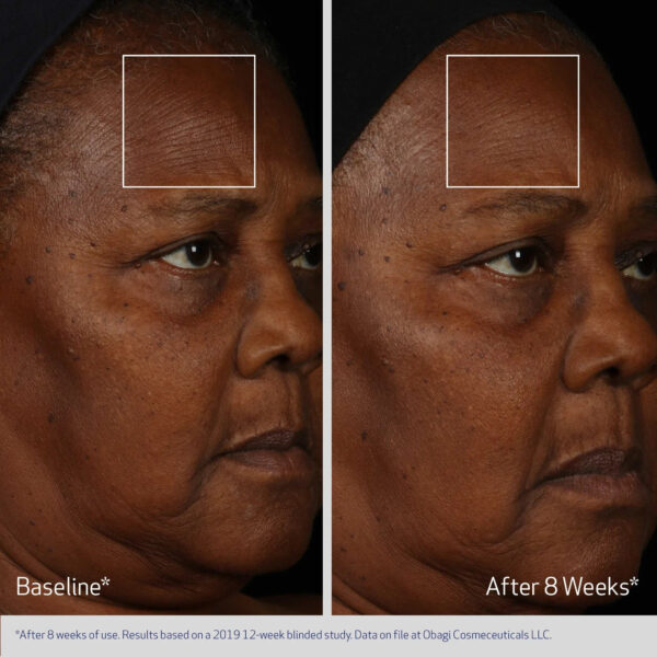Obagi ELASTIderm Facial Serum - Image 4