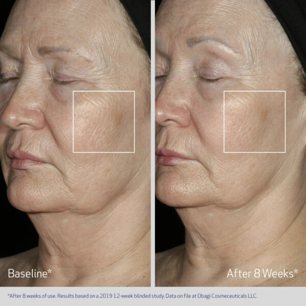 Obagi ELASTIderm Facial Serum - Image 5