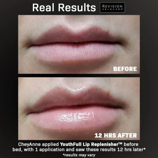 Revision YouthFull Lip Replenisher - Image 3