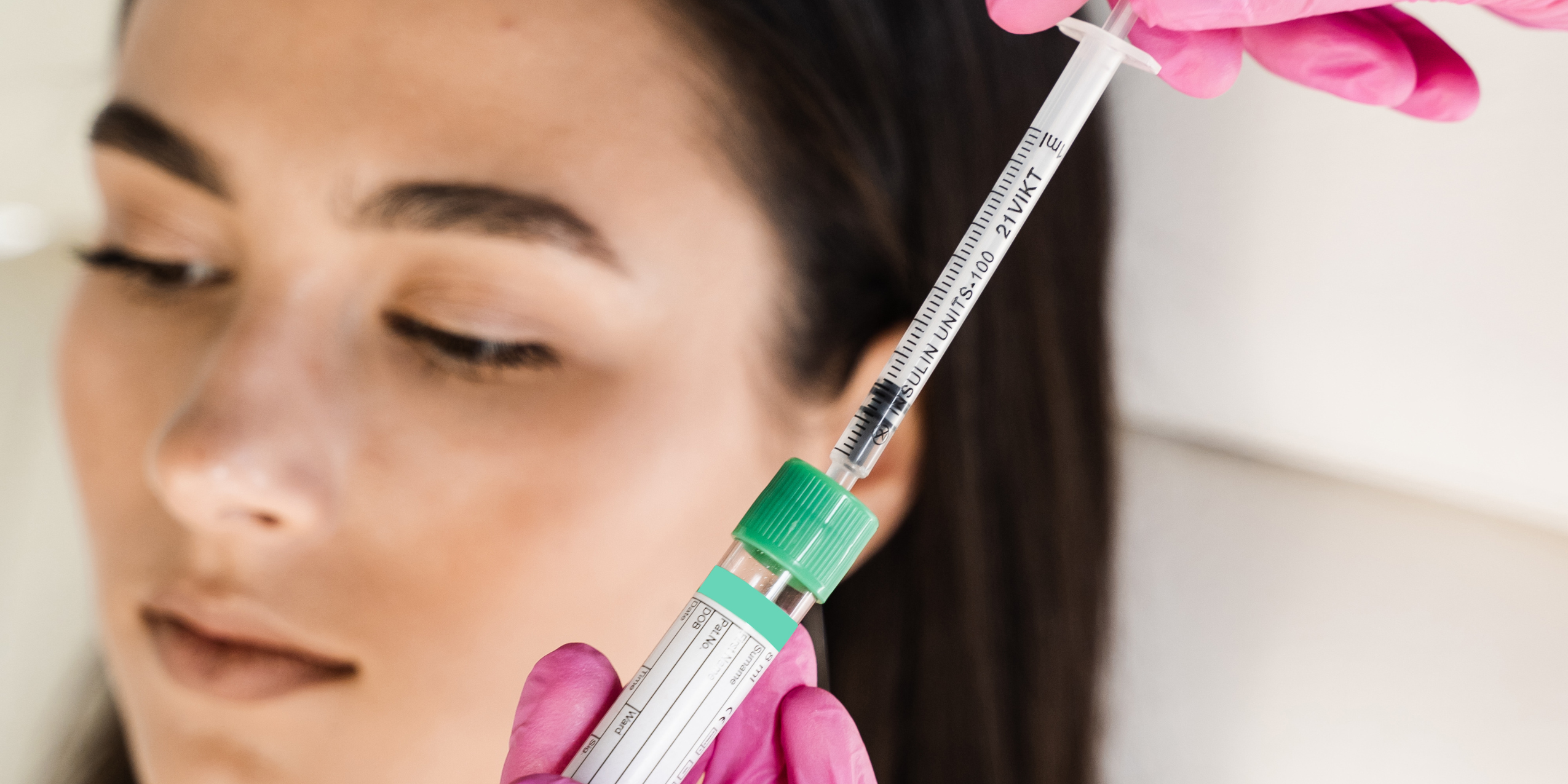 Managing Expectations: Realistic Ariessence PDGF Results